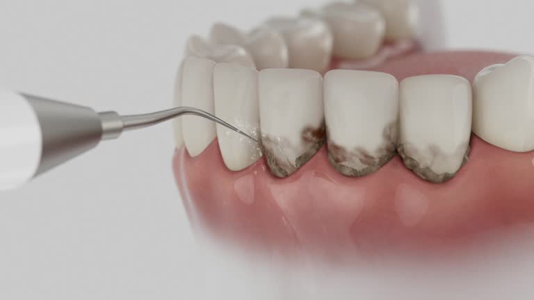 Reliable Dental contractor in Lebanon, OH by Dentist Open Now